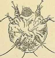 An illustration from An American text-book of genito-urinary diseases, syphilis and diseases of the skin / Ed. by L. Bolton Bangs ... and W. A. Hardaway ... Illustrated with 300 engravings and 20 full-page colored plates. (1898)
