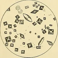 An illustration from An American text-book of genito-urinary diseases, syphilis and diseases of the skin / Ed. by L. Bolton Bangs ... and W. A. Hardaway ... Illustrated with 300 engravings and 20 full-page colored plates. (1898)