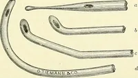 An illustration from An American text-book of genito-urinary diseases, syphilis and diseases of the skin / Ed. by L. Bolton Bangs ... and W. A. Hardaway ... Illustrated with 300 engravings and 20 full-page colored plates. (1898)