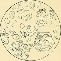 Picture 4 of 146 from An American text-book of genito-urinary diseases, syphilis and diseases of the skin / Ed. by L. Bolton Bangs ... and W. A. Hardaway ... Illustrated with 300 engravings and 20 full-page colored plates. (1898), leaf 31