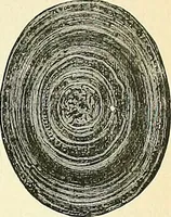 An illustration from An American text-book of genito-urinary diseases, syphilis and diseases of the skin / Ed. by L. Bolton Bangs ... and W. A. Hardaway ... Illustrated with 300 engravings and 20 full-page colored plates. (1898)