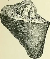 Picture 58 of 146 from An American text-book of genito-urinary diseases, syphilis and diseases of the skin / Ed. by L. Bolton Bangs ... and W. A. Hardaway ... Illustrated with 300 engravings and 20 full-page colored plates. (1898), leaf 431
