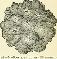 Picture 59 of 146 from An American text-book of genito-urinary diseases, syphilis and diseases of the skin / Ed. by L. Bolton Bangs ... and W. A. Hardaway ... Illustrated with 300 engravings and 20 full-page colored plates. (1898), leaf 431