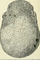 Picture 61 of 146 from An American text-book of genito-urinary diseases, syphilis and diseases of the skin / Ed. by L. Bolton Bangs ... and W. A. Hardaway ... Illustrated with 300 engravings and 20 full-page colored plates. (1898), leaf 432