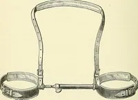 An illustration from An American text-book of genito-urinary diseases, syphilis and diseases of the skin / Ed. by L. Bolton Bangs ... and W. A. Hardaway ... Illustrated with 300 engravings and 20 full-page colored plates. (1898)