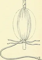 An illustration from An American text-book of genito-urinary diseases, syphilis and diseases of the skin / Ed. by L. Bolton Bangs ... and W. A. Hardaway ... Illustrated with 300 engravings and 20 full-page colored plates. (1898)