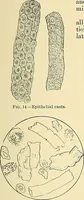 Picture 12 of 146 from An American text-book of genito-urinary diseases, syphilis and diseases of the skin / Ed. by L. Bolton Bangs ... and W. A. Hardaway ... Illustrated with 300 engravings and 20 full-page colored plates. (1898), leaf 47