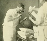 An illustration from An American text-book of genito-urinary diseases, syphilis and diseases of the skin / Ed. by L. Bolton Bangs ... and W. A. Hardaway ... Illustrated with 300 engravings and 20 full-page colored plates. (1898)