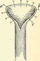 An illustration from An American text-book of genito-urinary diseases, syphilis and diseases of the skin / Ed. by L. Bolton Bangs ... and W. A. Hardaway ... Illustrated with 300 engravings and 20 full-page colored plates. (1898)