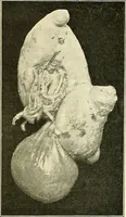 Picture 102 of 146 from An American text-book of genito-urinary diseases, syphilis and diseases of the skin / Ed. by L. Bolton Bangs ... and W. A. Hardaway ... Illustrated with 300 engravings and 20 full-page colored plates. (1898), leaf 592