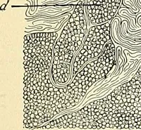 An illustration from An American text-book of genito-urinary diseases, syphilis and diseases of the skin / Ed. by L. Bolton Bangs ... and W. A. Hardaway ... Illustrated with 300 engravings and 20 full-page colored plates. (1898)