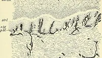 An illustration from An American text-book of genito-urinary diseases, syphilis and diseases of the skin / Ed. by L. Bolton Bangs ... and W. A. Hardaway ... Illustrated with 300 engravings and 20 full-page colored plates. (1898)