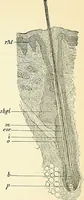 An illustration from An American text-book of genito-urinary diseases, syphilis and diseases of the skin / Ed. by L. Bolton Bangs ... and W. A. Hardaway ... Illustrated with 300 engravings and 20 full-page colored plates. (1898)