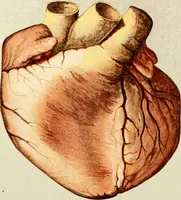 Picture 44 of 52 from Diseases of the heart and arterial system : designed to be a practical presentation of the subject for the use of students and practitioners of medicine / by Robert H. Babcock ... with three coloured plates and one hundred and thirty-nine illustrations. (1903), leaf 611