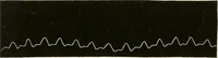 An illustration from Diseases of the heart and arterial system : designed to be a practical presentation of the subject for the use of students and practitioners of medicine / by Robert H. Babcock ... with three coloured plates and one hundred and thirty-nine illustrations. (1903)