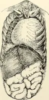 An illustration from Diseases of the heart and arterial system : designed to be a practical presentation of the subject for the use of students and practitioners of medicine / by Robert H. Babcock ... with three coloured plates and one hundred and thirty-nine illustrations. (1903)