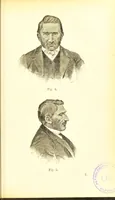 An illustration from Nouvelles recherches de psychiatrie et d'anthropologie criminelle / par Cesare Lombroso. (1892)