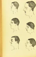 An illustration from Nouvelles recherches de psychiatrie et d'anthropologie criminelle / par Cesare Lombroso. (1892)
