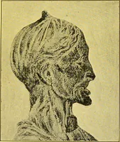 An illustration from The female offender / by Cæsar Lombroso and William Ferrero ; with an introduction by W. Douglas Morrison. (1895)