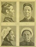 An illustration from The female offender / by Cæsar Lombroso and William Ferrero ; with an introduction by W. Douglas Morrison. (1895)
