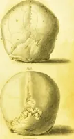 Picture 3 of 14 from Illustrations of phrenology / by Sir G. S. Mackenzie. (1820), leaf 291