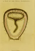 Picture 1 of 2 from Outlines of medico-chirurgical science ; containing remarks on medical education, and illustrations of the application of anatomy, physiology, and pathology, to the principal practical points of medicine and surgery. With coloured plates / [by] Thomas Turner. (1827), leaf 43