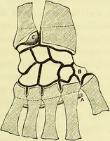 An illustration from A course of operative surgery / with plates drawn from nature by M. Léveillé and coloured by hand under his direction ; by Christopher Heath. (1877)