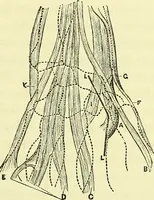 An illustration from A course of operative surgery / with plates drawn from nature by M. Léveillé and coloured by hand under his direction ; by Christopher Heath. (1877)