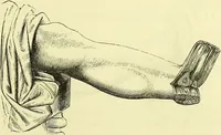 An illustration from A course of operative surgery / with plates drawn from nature by M. Léveillé and coloured by hand under his direction ; by Christopher Heath. (1877)