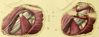 An illustration from A course of operative surgery / with plates drawn from nature by M. Léveillé and coloured by hand under his direction ; by Christopher Heath. (1877)