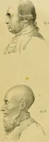 An illustration from Phrenology, in connexion with the study of physiognomy / by J. G. Spurzheim. (1826)