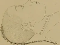 An illustration from Principes et résumé de physiognomie / par le docteur B*** D***. (1859)