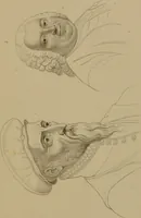 An illustration from Principes et résumé de physiognomie / par le docteur B*** D***. (1859)