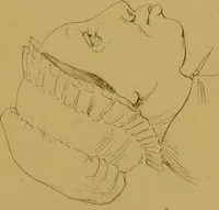 An illustration from Principes et résumé de physiognomie / par le docteur B*** D***. (1859)