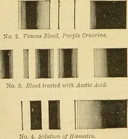 An illustration from The microscope: its history, construction, and application : being a familiar introduction to the use of the instrument and the study of microscopical sciences / by Jabez Hogg. (1869)