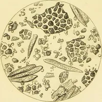 An illustration from The microscope: its history, construction, and application : being a familiar introduction to the use of the instrument and the study of microscopical sciences / by Jabez Hogg. (1869)