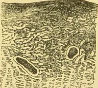 An illustration from The microscope: its history, construction, and application : being a familiar introduction to the use of the instrument and the study of microscopical sciences / by Jabez Hogg. (1869)