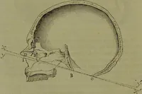 An illustration from Instructions craniologiques et craniométriques de la Société d'anthropologie de Paris / par Paul Broca. (1875)