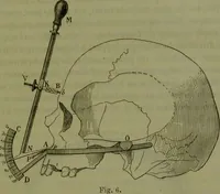 Picture 6 of 21 from Instructions craniologiques et craniométriques de la Société d'anthropologie de Paris / par Paul Broca. (1875), leaf 99
