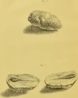 An illustration from Further observations on the variolæ vaccinæ, illustrated with coloured engravings from original drawings / By Robert Ceely. (1842)