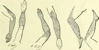 An illustration from Traité pratique et théorique de la lèpre / par Henri Leloir. (1886)