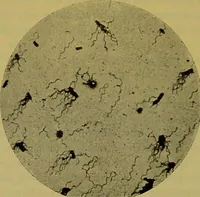 An illustration from The microscope : its history, construction, and application, being a familiar introduction to the use of the instrument, and the study of microscopical science / by Jabez Hogg. (1898)