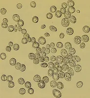 An illustration from The microscope : its history, construction, and application, being a familiar introduction to the use of the instrument, and the study of microscopical science / by Jabez Hogg. (1898)