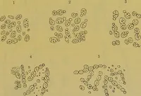 An illustration from The microscope : its history, construction, and application, being a familiar introduction to the use of the instrument, and the study of microscopical science / by Jabez Hogg. (1898)
