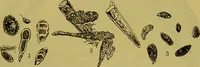 An illustration from The microscope : its history, construction, and application, being a familiar introduction to the use of the instrument, and the study of microscopical science / by Jabez Hogg. (1898)