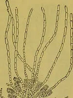 An illustration from The microscope : its history, construction, and application, being a familiar introduction to the use of the instrument, and the study of microscopical science / by Jabez Hogg. (1898)