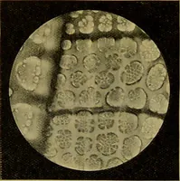 An illustration from The microscope : its history, construction, and application, being a familiar introduction to the use of the instrument, and the study of microscopical science / by Jabez Hogg. (1898)