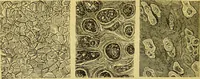 An illustration from The microscope : its history, construction, and application, being a familiar introduction to the use of the instrument, and the study of microscopical science / by Jabez Hogg. (1898)