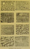 Picture 404 of 409 from The microscope : its history, construction, and application, being a familiar introduction to the use of the instrument, and the study of microscopical science / by Jabez Hogg. (1898), leaf 729