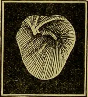 An illustration from Diseases of the ear, nose, and throat and their accessory cavities : A condensed text-book / By Seth Scott Bishop. (1897)